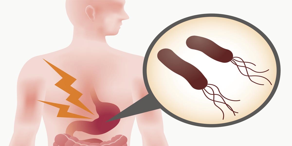 اضغط على الصورة لعرض أكبر

الاسم: H. pylori2.jpg
الحجم: 56.6 كيلوبايت
رقم التعريف: 225709